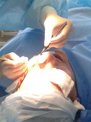 Блефаропластика в ЕМЦ.JPG