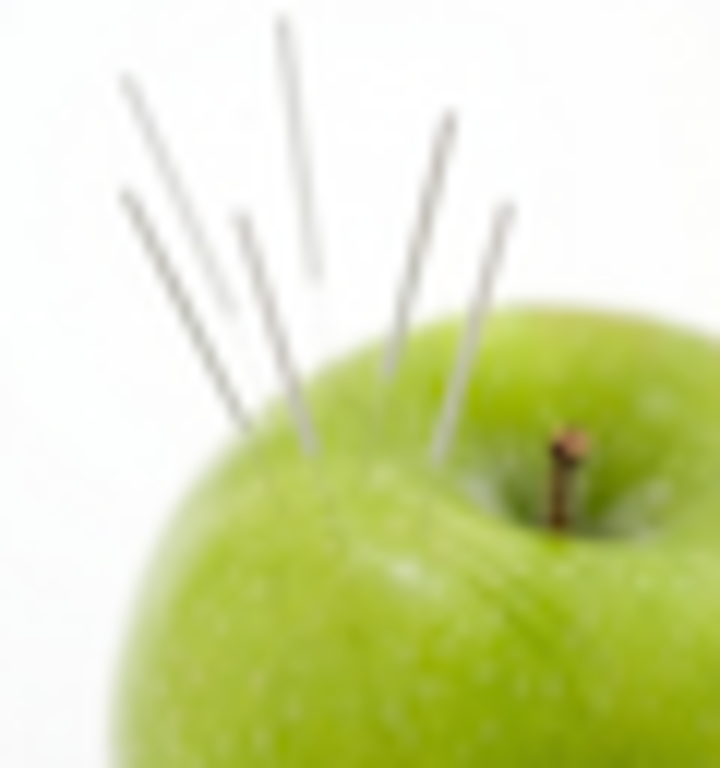 Иглоукалывание: от каких болезней помогает иглорефлексотерапия